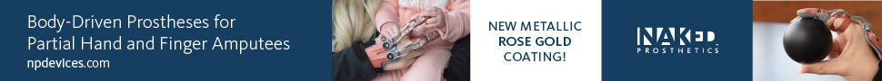 Advertisement - Naked Prosthetics Body-driven prostheses for partial hand and finger amputees.